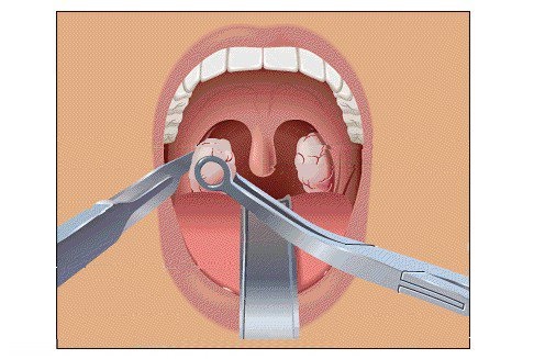 d12_08_03_06_0805_25119