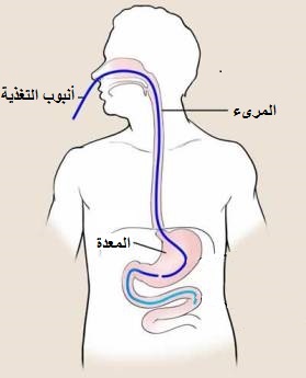 تغذية الصناعيًّة
