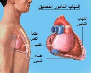 %d8%a7%d9%84%d8%aa%d9%87%d8%a7%d8%a8-%d8%a7%d9%84%d8%aa%d8%a7%d9%85%d9%88%d8%b1